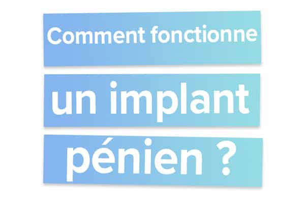 Comment fonctionne un implant pénien